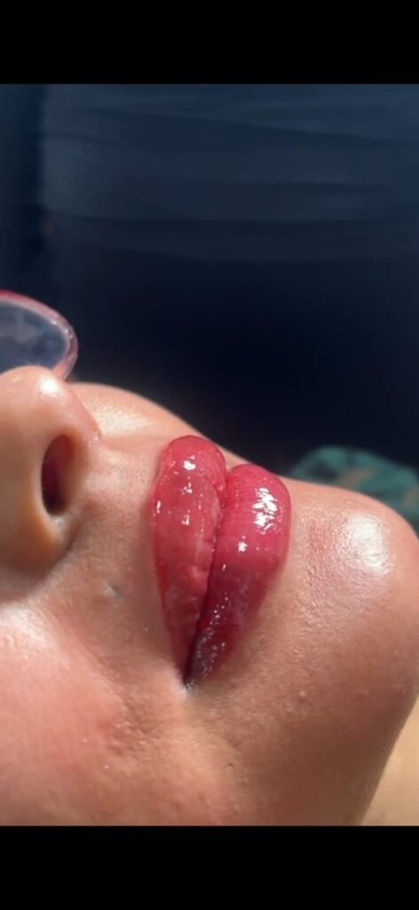Lip Tattooing